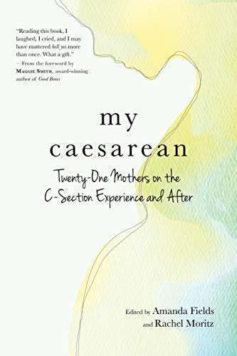 My Cesarean